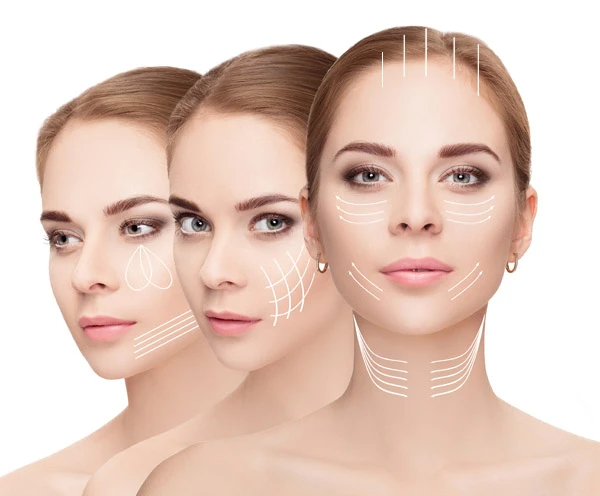 Microneedling bei HYALVOMED in Köln und Aachen