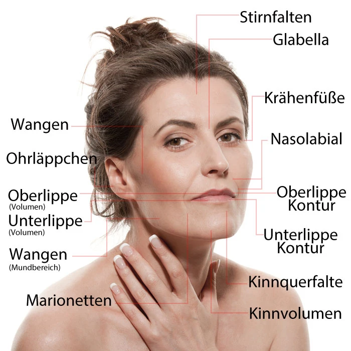 Gesichtszonen mit typischen Hyaluron-Mengen in Millilitern